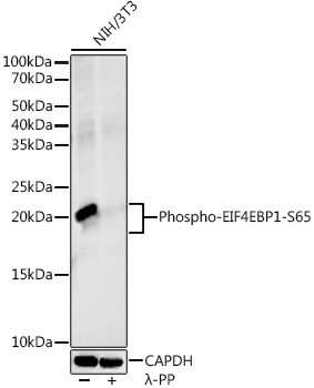 Phospho-4EBP1 (Ser65) Antibody in Western Blot (WB)