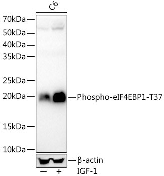 Phospho-4EBP1 (Thr37) Antibody in Western Blot (WB)