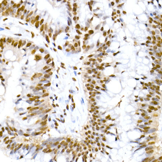 Phospho-MDM2 (Ser166) Antibody in Immunohistochemistry (Paraffin) (IHC (P))