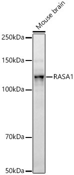 RASA1 Antibody in Western Blot (WB)