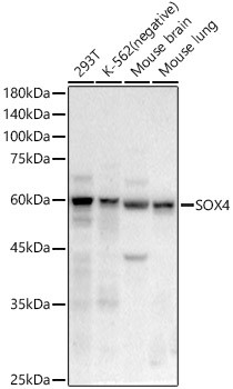 SOX4 Antibody in Western Blot (WB)