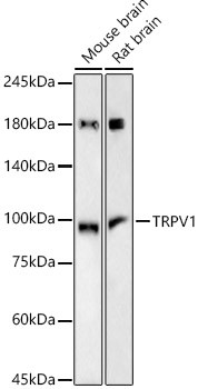 TRPV1 Antibody in Western Blot (WB)