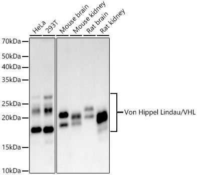 VHL Antibody in Western Blot (WB)