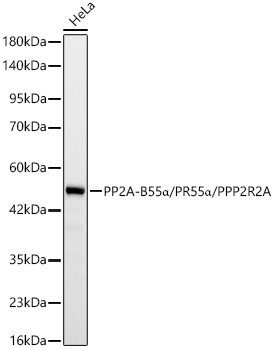 PPP2R2A Antibody in Western Blot (WB)