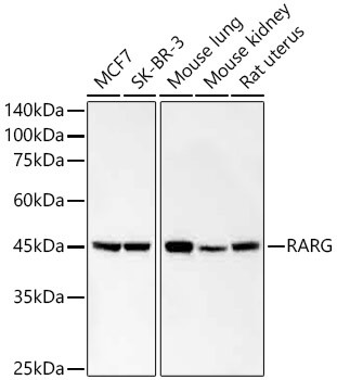 RAR gamma-1,2 Antibody in Western Blot (WB)