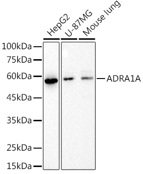 alpha-1a Adrenergic Receptor Antibody in Western Blot (WB)