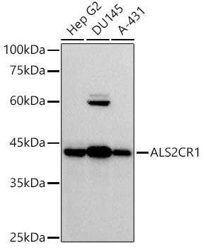 ALS2CR1 Antibody in Western Blot (WB)