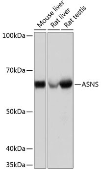 Asparagine Synthetase Antibody in Western Blot (WB)