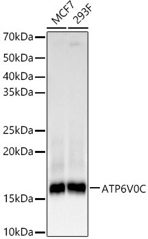 ATP6V0C Antibody in Western Blot (WB)