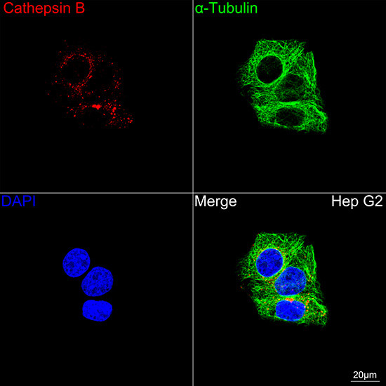 Cathepsin B Antibody in Immunocytochemistry (ICC/IF)