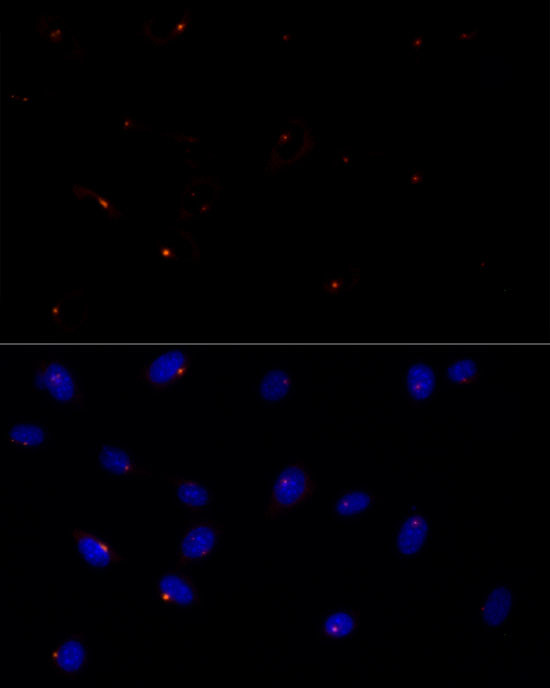 FGFR1OP Antibody in Immunocytochemistry (ICC/IF)