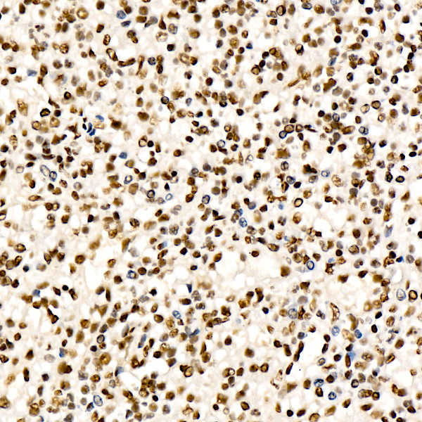 CHD4 Antibody in Immunohistochemistry (Paraffin) (IHC (P))