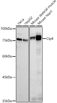 TRIP10 Antibody in Western Blot (WB)