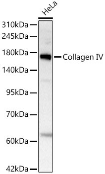 Collagen IV Antibody in Western Blot (WB)