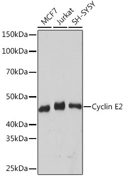 Cyclin E2 Antibody in Western Blot (WB)