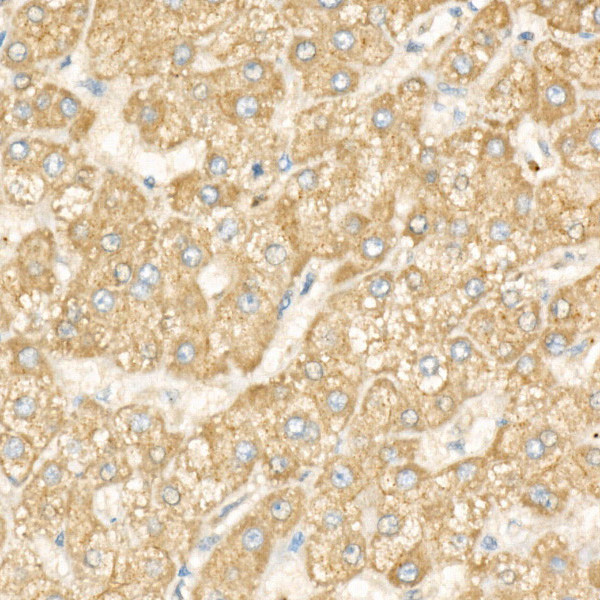 DGAT1 Antibody in Immunohistochemistry (Paraffin) (IHC (P))