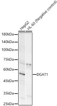 DGAT1 Antibody in Western Blot (WB)