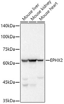 EPHX2 Antibody in Western Blot (WB)