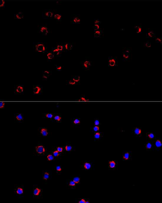 KCNN3 Antibody in Immunocytochemistry (ICC/IF)