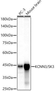 KCNN3 Antibody in Western Blot (WB)