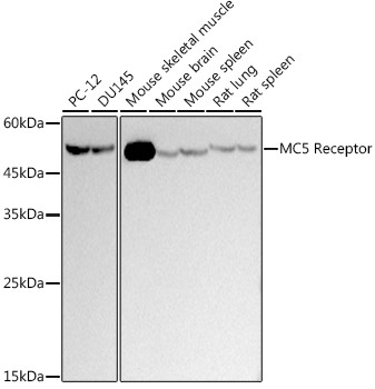 MC5R Antibody in Western Blot (WB)