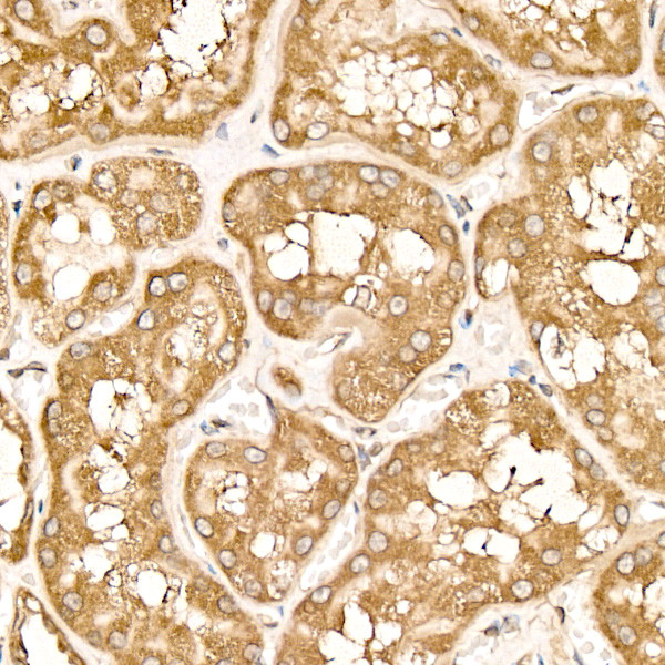 METTL4 Antibody in Immunohistochemistry (Paraffin) (IHC (P))