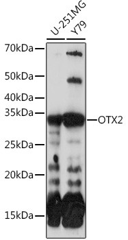 OTX2 Antibody in Western Blot (WB)