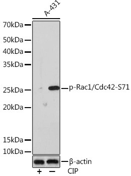 Phospho-RAC1/CDC42 (Ser71) Antibody in Western Blot (WB)