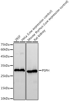 PSPH Antibody in Western Blot (WB)