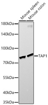 TAP1 Antibody in Western Blot (WB)