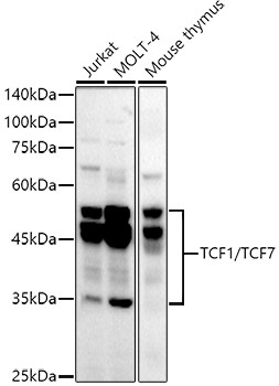 TCF7 Antibody in Western Blot (WB)