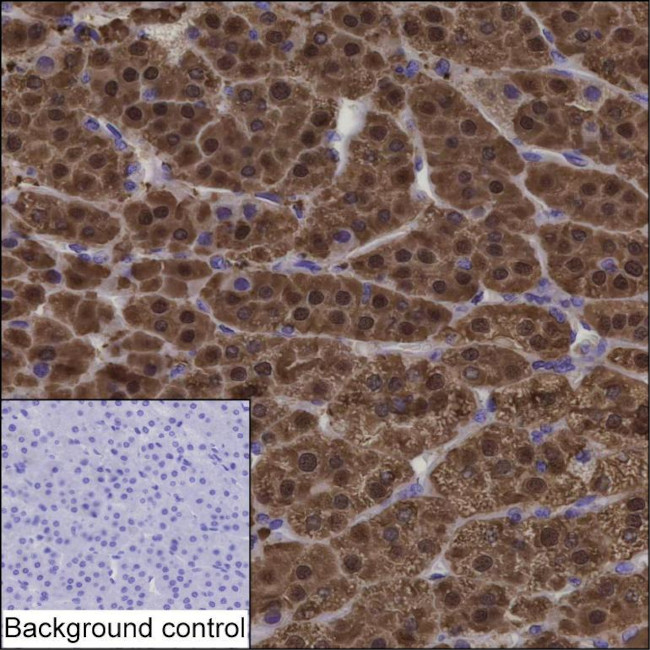 AKR1B1 Antibody in Immunohistochemistry (Paraffin) (IHC (P))