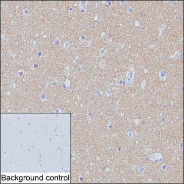 SNAP25 Antibody in Immunohistochemistry (Paraffin) (IHC (P))