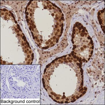 DNAJB6 Antibody in Immunohistochemistry (Paraffin) (IHC (P))