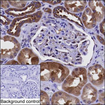 PKD2 Antibody in Immunohistochemistry (Paraffin) (IHC (P))