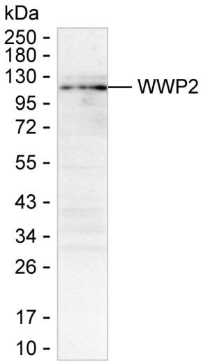 AIP2 Antibody in Western Blot (WB)