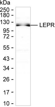 Leptin Receptor Antibody in Western Blot (WB)