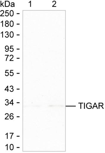 TIGAR Antibody in Western Blot (WB)