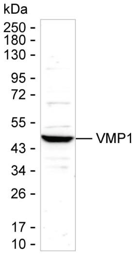 VMP1 Antibody in Western Blot (WB)