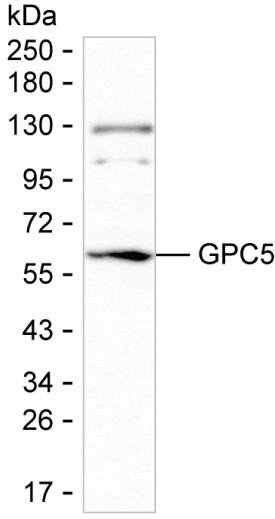 Glypican 5 Antibody in Western Blot (WB)