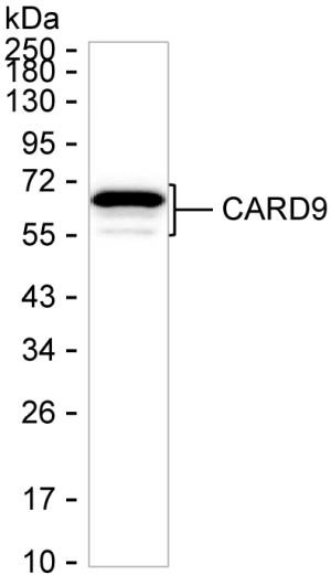 CARD9 Antibody in Western Blot (WB)