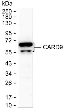 CARD9 Antibody in Western Blot (WB)