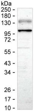 PDE5 Antibody in Western Blot (WB)