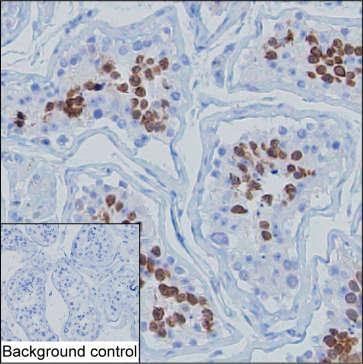 TRAFD1 Antibody in Immunohistochemistry (Paraffin) (IHC (P))