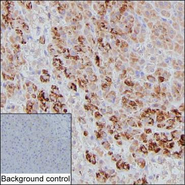 ASPM Antibody in Immunohistochemistry (Paraffin) (IHC (P))