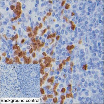 CDA Antibody in Immunohistochemistry (Paraffin) (IHC (P))