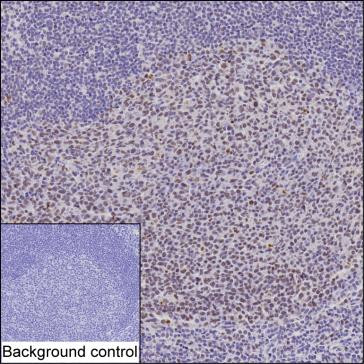 TOP1 Antibody in Immunohistochemistry (Paraffin) (IHC (P))