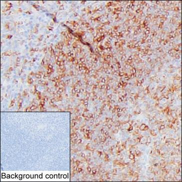 CD83 Antibody in Immunohistochemistry (Paraffin) (IHC (P))