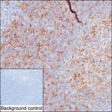 CD83 Antibody in Immunohistochemistry (Paraffin) (IHC (P))