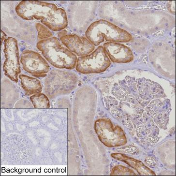 MTHFD2 Antibody in Immunohistochemistry (Paraffin) (IHC (P))